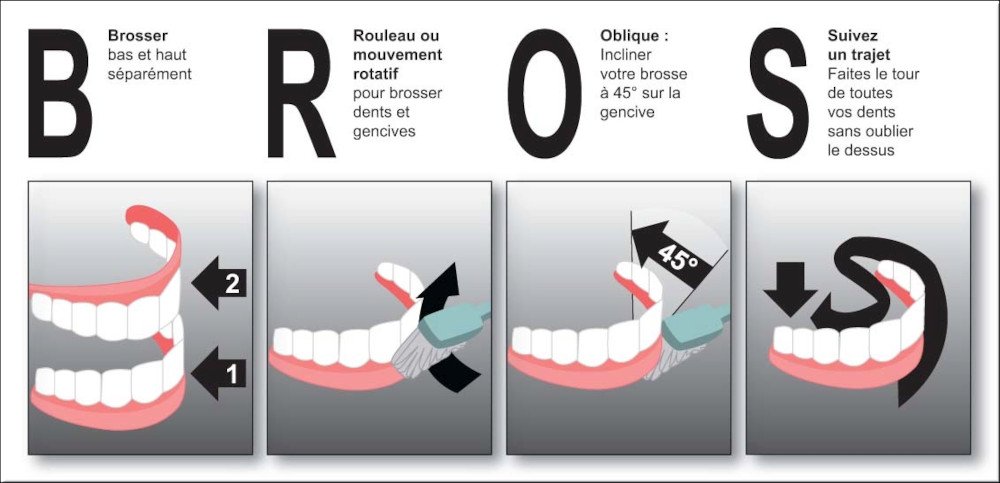 conseils aux patients le brossage dentaire