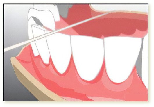 brossage des dents fil dentaire