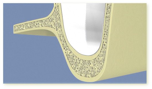 Greffe osseuse sinus Isère 02